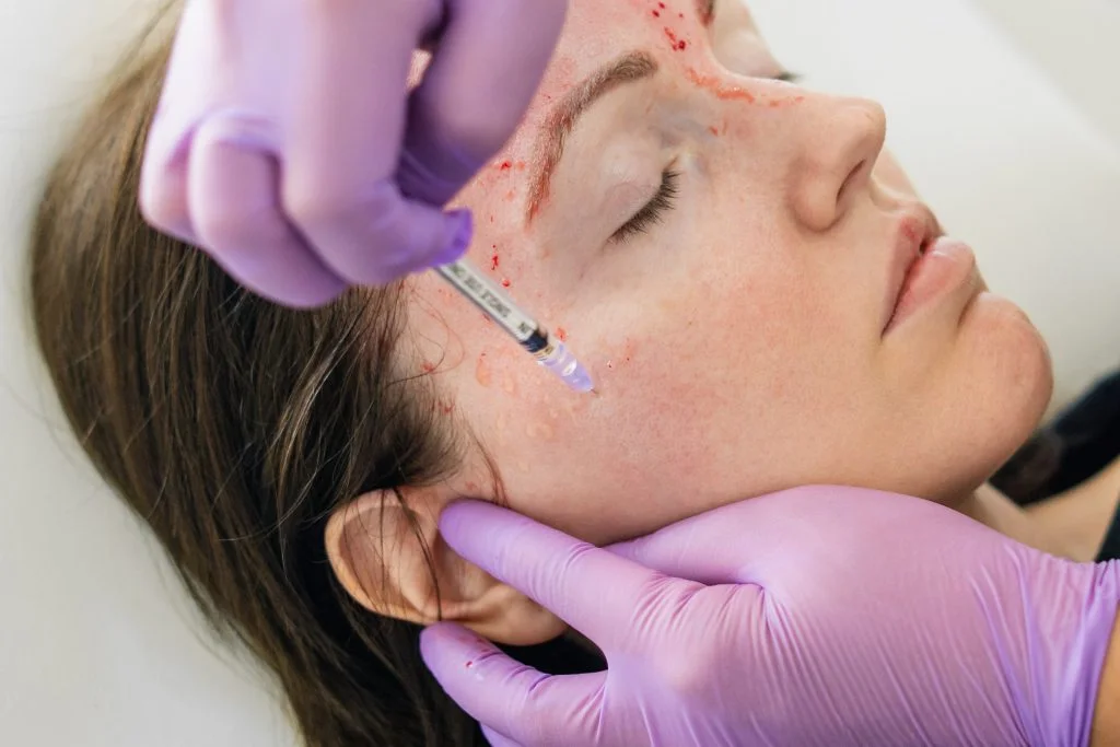 Skin rejuvenation treatment